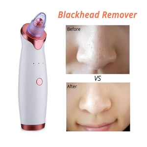 Blackhead Remover Pore Cleaner